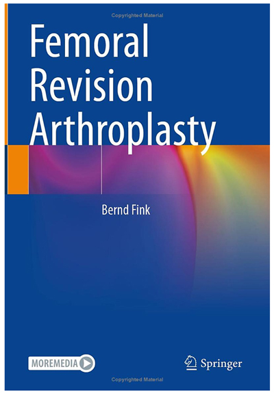 Femoral Revision Arthroplasty of Mr. Prof. Dr. med. Fink refers to the OrthoClast system