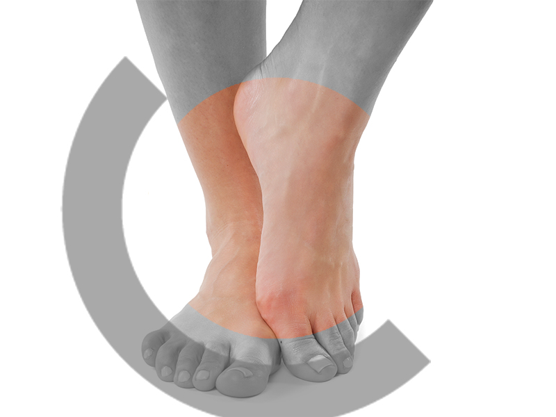 endocon Orthopädie Anwendungsbereich Fuß